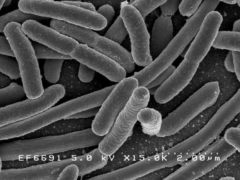 Fertőző bacilusokat találtak a gyilkostói panzió vízében