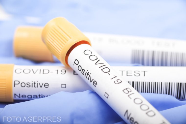 Félezer fölé ugrott a koronavírusos fertőzöttek száma az országban