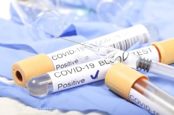 Koronavírus: orvosok és ápolók csoportos megfertőződése miatt ideiglenesen bezárták a suceavai kórházat