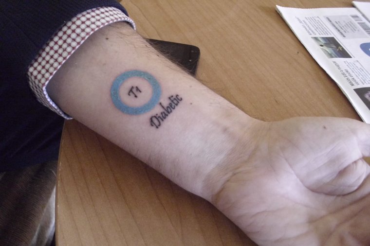 Cukorbetegeknek tervezett logót egy tetoválóművész – életmentő lehet a csuklóra varrva