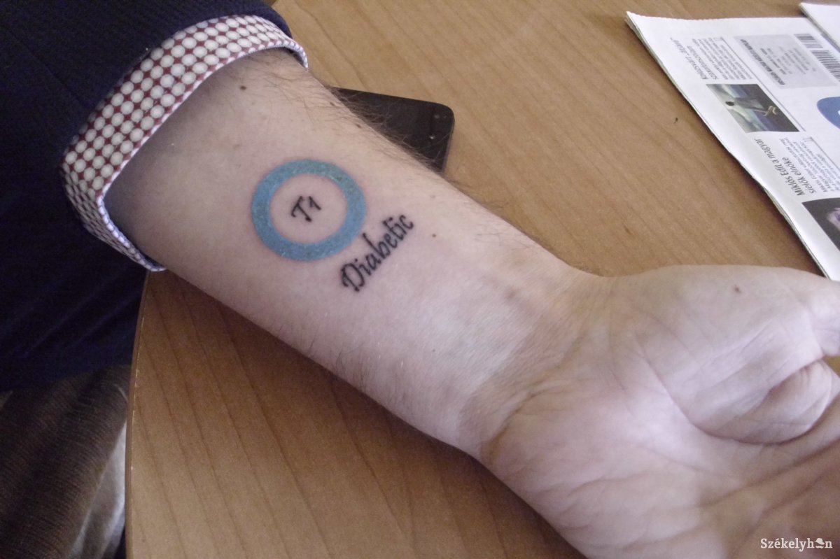 Cukorbetegeknek tervezett logót egy tetoválóművész – életmentő lehet a csuklóra varrva