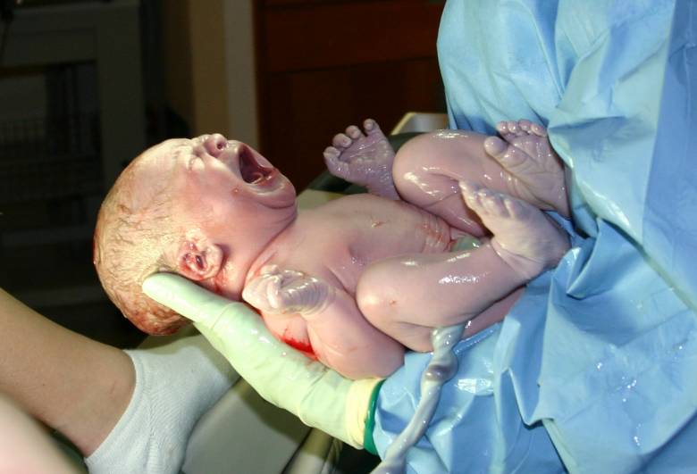 súlycsökkenés születés után újszülött hasi zsírvesztés fogyás után