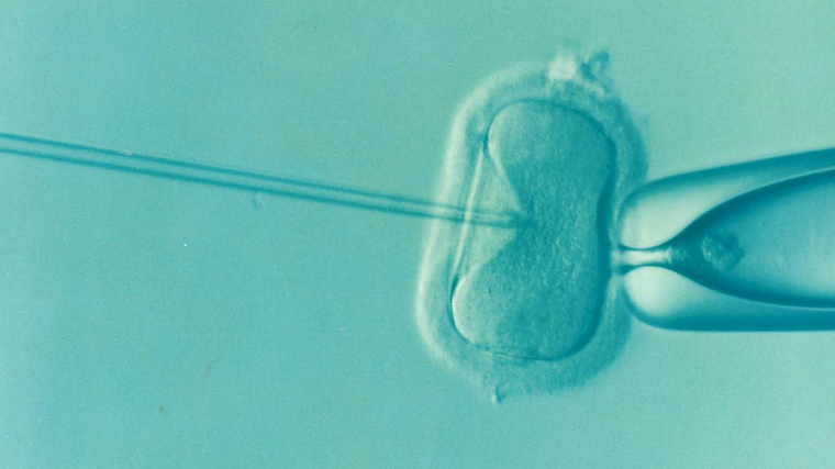 Először növesztettek emberi petesejtet laboratóriumban a teljes érésig