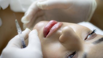 Igazi plasztikai sebészre szorultak fiatal nők, akiknek egy sarlatán töltötte fel az ajkukat hialuronsavval