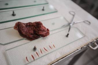 Egy házisertés és egy vaddisznó húsában is kimutatták a trichinella-fertőzést